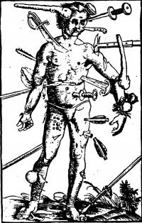 This 'wound man' illustrated 1536 medical book shows the wounds which surgeons felt able to treat successfully.