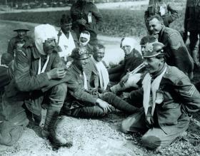 Wounded British troops wearing German helmets at Heilly, September 1916. (Imperial War Museum)
